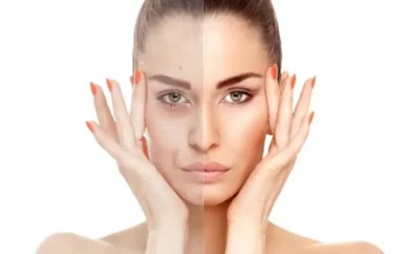 Discover Advanced Skin Tightening in Tysons Corner for Firmer, Youthful Skin