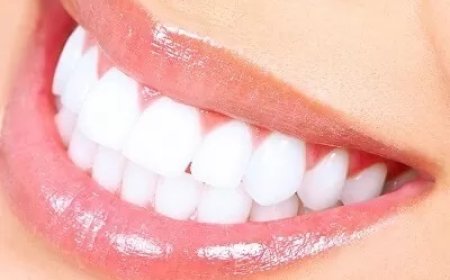 Can Teenagers Get Laser Teeth Whitening?