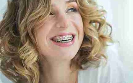 Discover the Confidence of a Radiant Smile in Grinstead