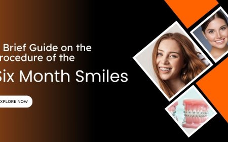 A Brief Guide on the Procedure of the Six Month Smiles