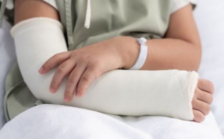 Do All Fractures Require Surgery? Expert Advice from an Orthopedic Doctor in Greater Noida