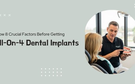 Know 8 Crucial Factors Before Getting All-On-4 Dental Implants