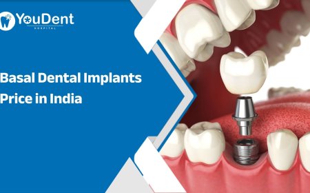 Basal Dental Implants Price in India