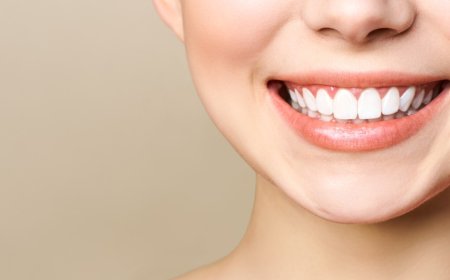 Teeth Whitening in Savannah