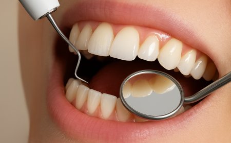 Teeth Scaling and Polishing: Benefits Beyond a Clean Smile
