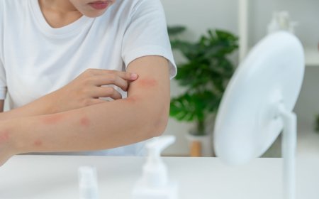 The Overlap Between Skin Health And Allergies: What Orlando Residents Should Know