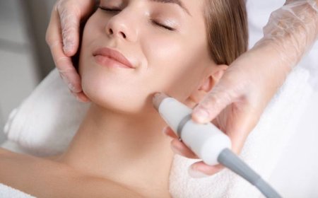 Laser Treatment Costs Decoded for Smooth, Flawless Skin Fast