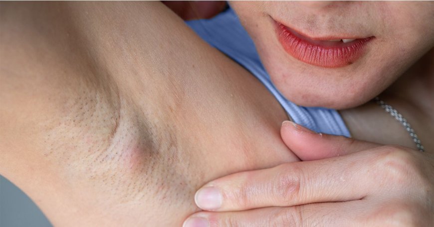 Underarm Whitening Treatment to Remove Dark Patches Safely