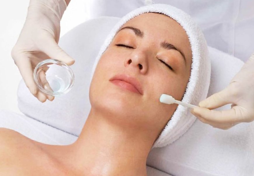 How to Reduce Chemical Peels Cost and Still Get Glowing Results